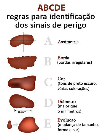 ABCDE
